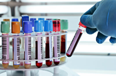 The US Government Can Now Collect DNA From Thousands of People Who Have Never Committed a Crime