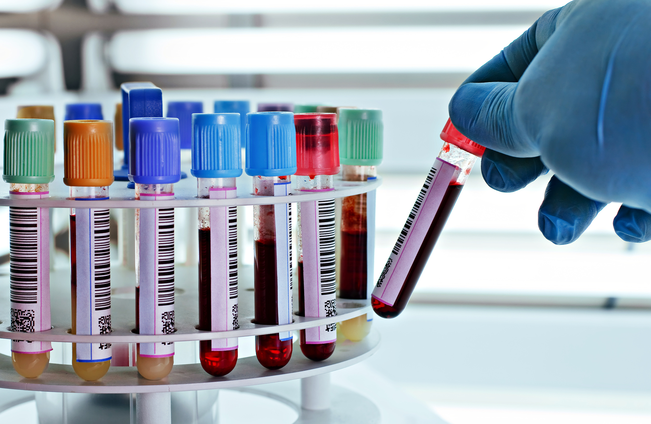 The US Government Can Now Collect DNA From Thousands of People Who Have Never Committed a Crime