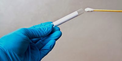 Collecting DNA From Asylum Seekers at the Border Raises Privacy Concerns